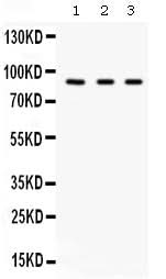 Anti-Factor B/CFB Antibody Picoband® Boster Bio