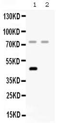 Anti-Factor I/CFI Antibody Picoband® Boster Bio