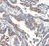 Anti-Calcitonin/CALCA Antibody Boster Bio
