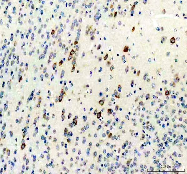 Anti-Calcitonin/CALCA Antibody Boster Bio