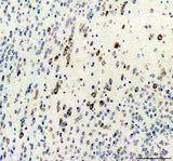 Anti-Calcitonin/CALCA Antibody Boster Bio