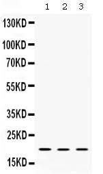 Anti-Alpha A Crystallin/CRYAA Antibody Picoband® Boster Bio