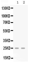 Anti-GRO gamma/CXCL3 Antibody Picoband® Boster Bio