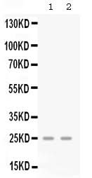 Anti-GRO gamma/CXCL3 Antibody Picoband® Boster Bio