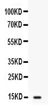 Anti-Intestinal FABP/FABP2 Antibody Picoband® Boster Bio