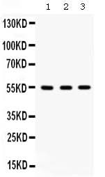 Anti-Integrin linked ILK Antibody Picoband® Boster Bio