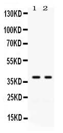 Anti-GAL4/LGALS4 Antibody Picoband® Boster Bio