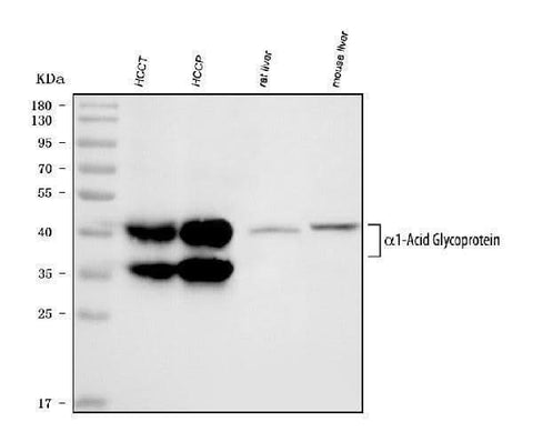 Anti-Alpha 1 Acid Glycoprotein/ORM1 Antibody Picoband® Boster Bio