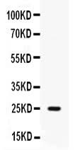 Anti-Elafin/Skalp/PI3 Antibody Picoband® Boster Bio