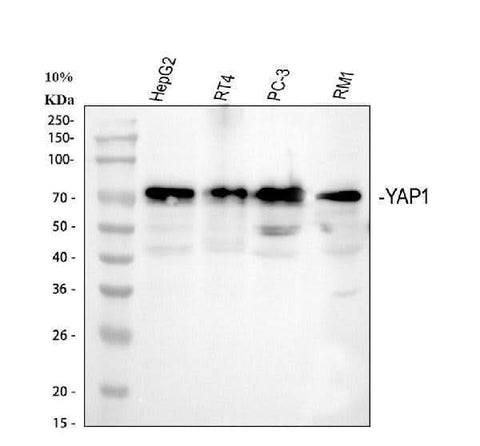 Anti-YAP1 Antibody Picoband® Boster Bio