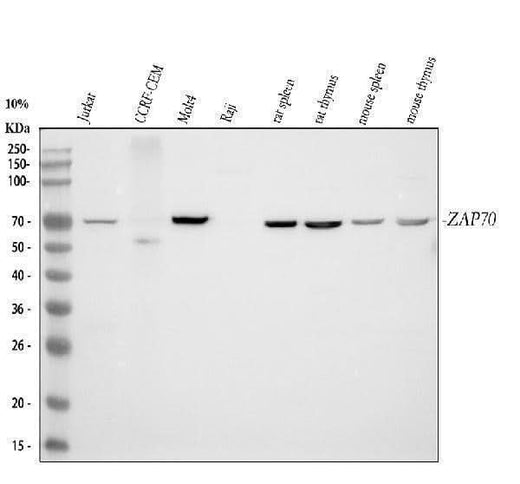 Anti-ZAP70 Antibody Picoband® Boster Bio