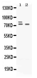 Anti-Plzf/ZBTB16 Antibody Picoband® Boster Bio