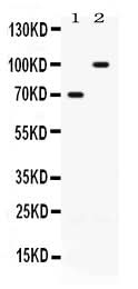 Anti-ZP1 Antibody Picoband® Boster Bio