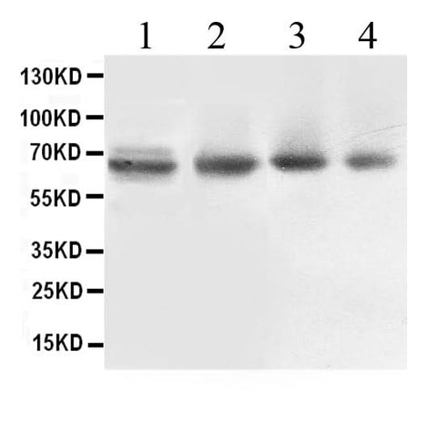 Anti-ABCB10 Antibody Picoband® Boster Bio