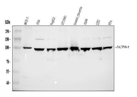 Anti-Alpha Actinin 4/ACTN4 Antibody Picoband® Boster Bio