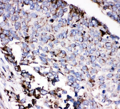 Anti-AEBP2 Antibody Picoband® Boster Bio