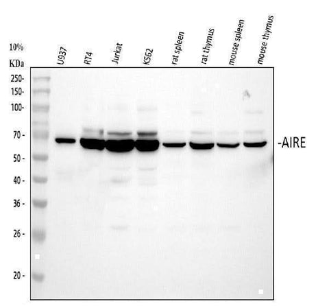 Anti-AIRE Antibody Picoband® Boster Bio