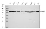 Anti-AMHR2 Antibody Picoband® Boster Bio
