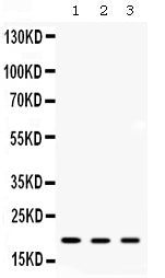 Anti-ARF6 Antibody Picoband® Boster Bio