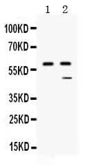 Anti-Carboxypeptidase B2/CPB2 Antibody Picoband® Boster Bio