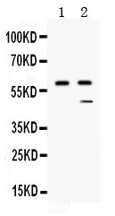 Anti-Carboxypeptidase B2/CPB2 Antibody Picoband® Boster Bio