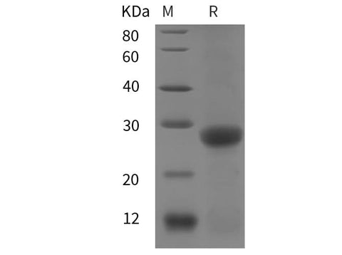SDS-PAGE analysis of Mouse CD20/MS4A1 proteins, 2 μg/lane of Recombinant Mouse CD20/MS4A1 proteins was resolved with SDS-PAGE under reducing conditions, showing bands at 28 kDa.