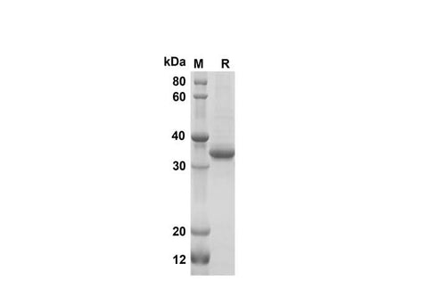 SDS-PAGE analysis of Mouse XCL1/Lymphotactin proteins, 2 μg/lane of Recombinant Mouse XCL1/Lymphotactin proteins was resolved with SDS-PAGE under reducing conditions, showing bands at 35 kDa.