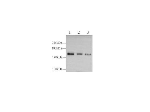 Anti-Human PODXL Antibody - ABMIUM