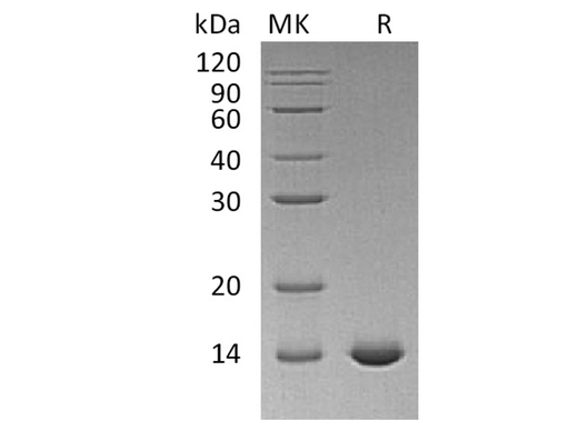 Recombinant Human Interleukin-2/IL-2 Protein (C145S) - ABMIUM