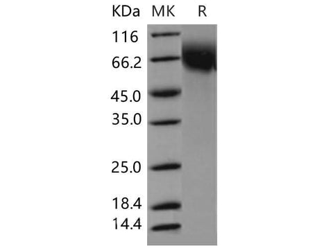 Recombinant Mouse CD6/TP120 Protein (His Tag) - ABMIUM