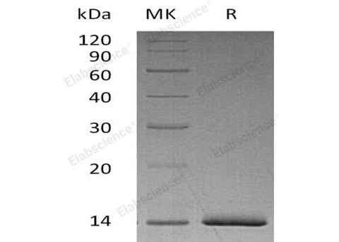 Recombinant Human Estrogen Receptor α/ER alpha Protein (His Tag) - ABMIUM
