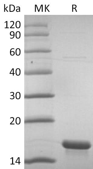 Recombinant SARS-CoV-2 NP CTD domain V2(C-6His) - ABMIUM
