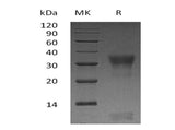 Recombinant Human PIK3IP1 Protein (His Tag) - ABMIUM