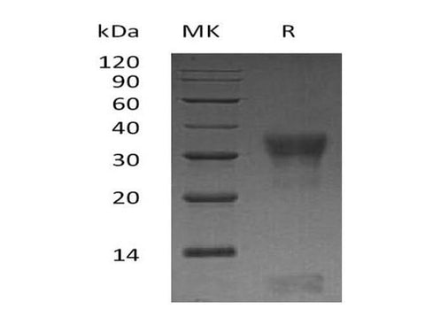 Recombinant Human PIK3IP1 Protein (His Tag) - ABMIUM