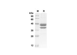 SDS-PAGE analysis of Mouse CCL1 proteins, 2 μg/lane of Recombinant Mouse CCL1 proteins was resolved with SDS-PAGE under reducing conditions, showing bands at 32.5 kDa.