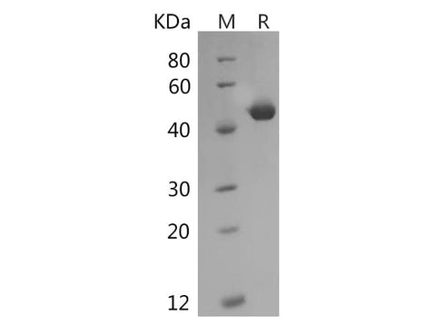 SDS-PAGE analysis of Human SerpinE1/PAI-1 proteins, 2 μg/lane of Recombinant Human SerpinE1/PAI-1 proteins was resolved with SDS-PAGE under reducing conditions, showing bands at 48 kDa.