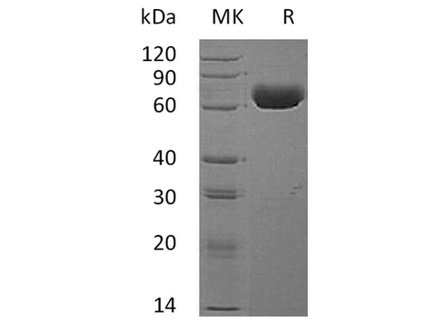 Recombinant Human EphA4 Protein - ABMIUM