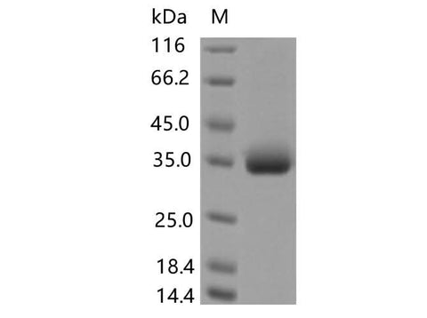 Recombinant SARS-CoV-2 Spike RBD(P479S)(His Tag) - ABMIUM