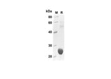 SDS-PAGE analysis of Human CXCL7/NAP-2 proteins , 2 μg/lane of Recombinant Human CXCL7/NAP-2 proteins was resolved with SDS-PAGE under reducing conditions , showing bands at 25 kDa.