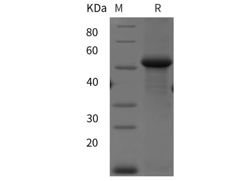SDS-PAGE analysis of Human Calnexin/CANX proteins, 2 μg/lane of Recombinant Human Calnexin/CANX proteins was resolved with SDS-PAGE under reducing conditions, showing bands at 42 kDa.
