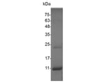 Recombinant Swine CXCL11 protein(His Tag) - ABMIUM