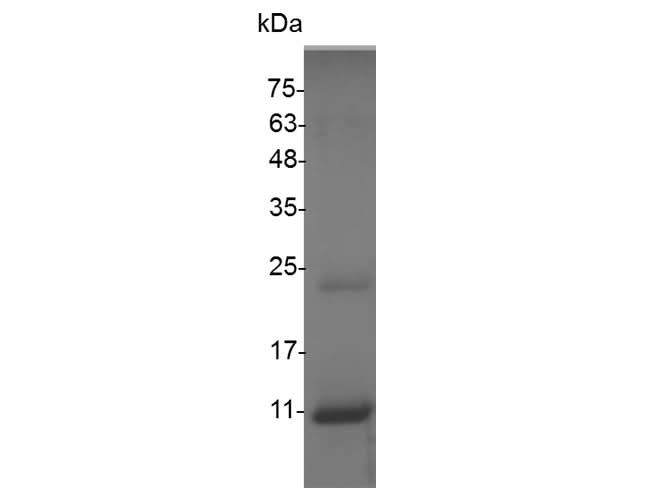 Recombinant Swine CXCL11 protein(His Tag) - ABMIUM