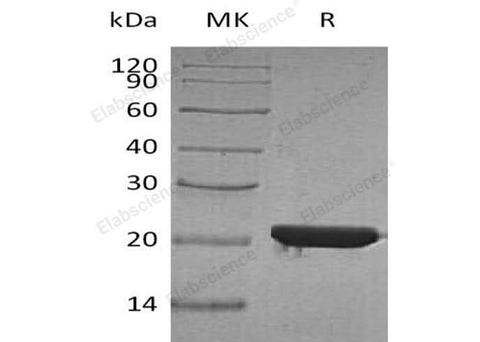 Recombinant Human FTH Protein (His Tag) - ABMIUM