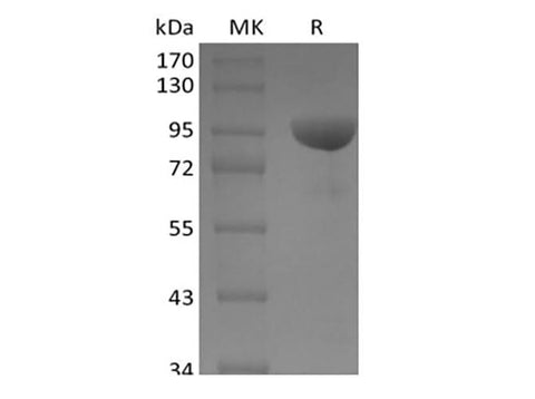 Recombinant Human Ephrin B Receptor 1/EphB1 (C-Fc) - ABMIUM