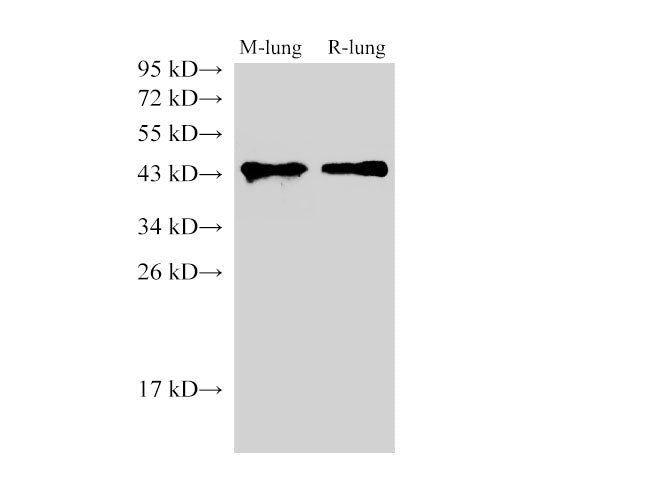 Anti-Human/Mouse/Rat CD38 Antibody - ABMIUM