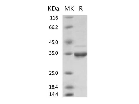 Recombinant SARS-CoV-2 Methyltransferase / ME Protein (His Tag) - ABMIUM