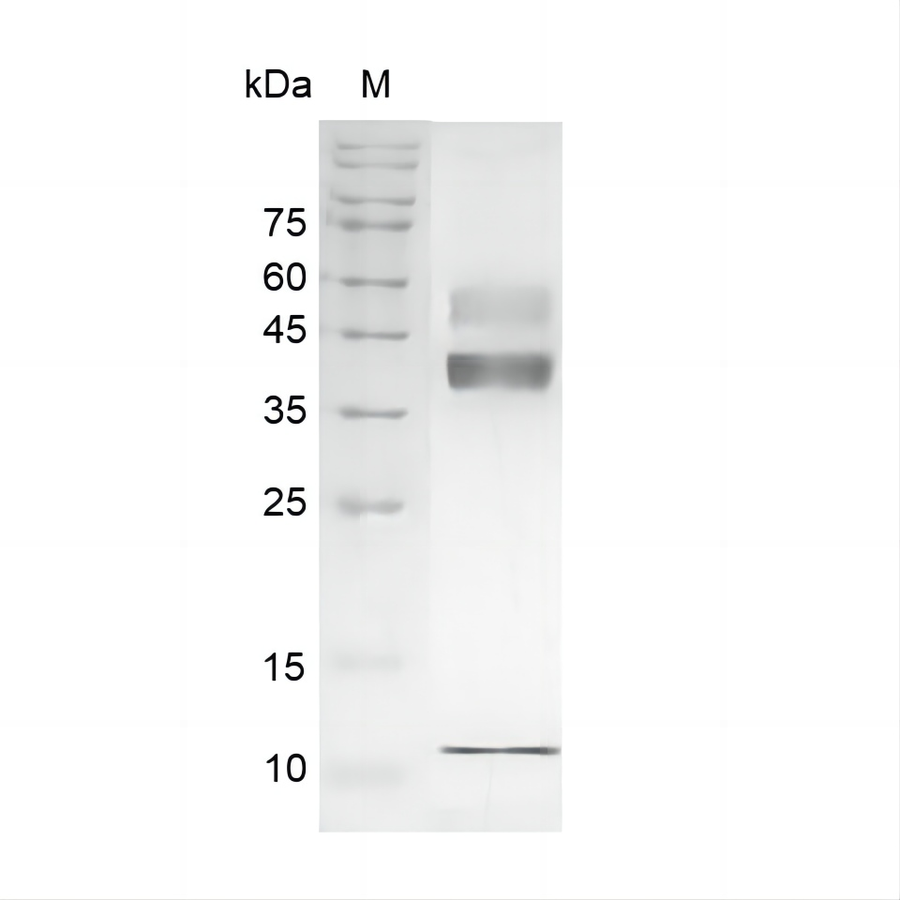 > 95 % as determined by reducing SDS-PAGE.