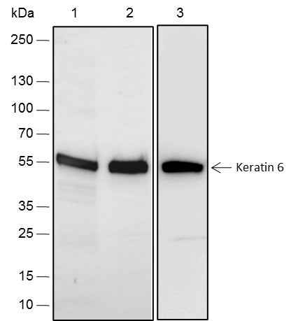 Anti-Human/Rat/Mouse Keratin 6 Antibody [A281] - ABMIUM