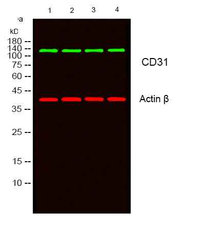 Anti-Human/Mouse/Rat CD31 Antibody [B858] - ABMIUM