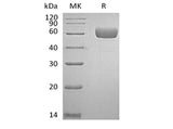 Recombinant Human Serpin A7/TBG (C-6His) - ABMIUM
